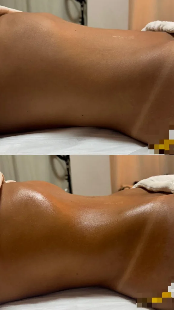 profissional de estética na vila prudente, sp