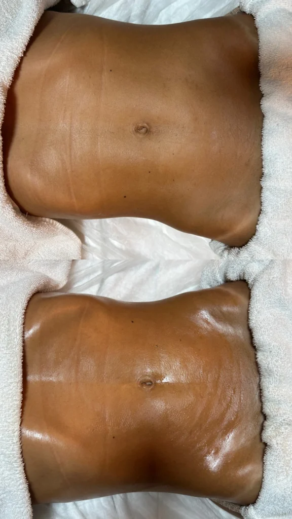 profissional de estética na vila prudente, sp