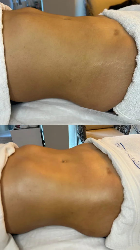 profissional de estética na vila prudente, sp